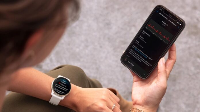 Garmin Venu 2 Plus app ECG come funziona